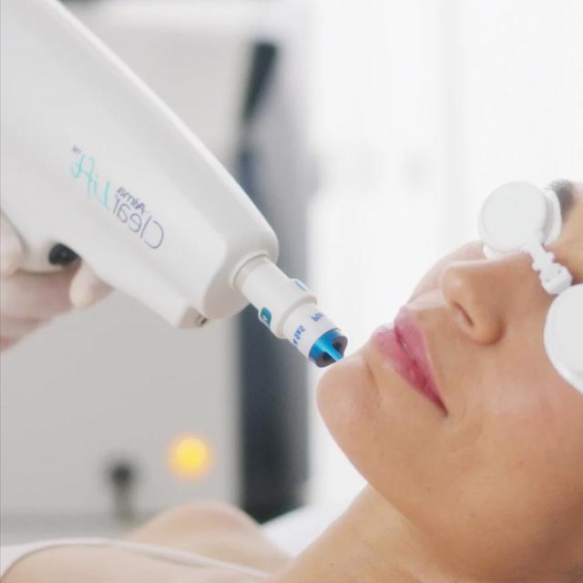 ClearLift laser package of 3